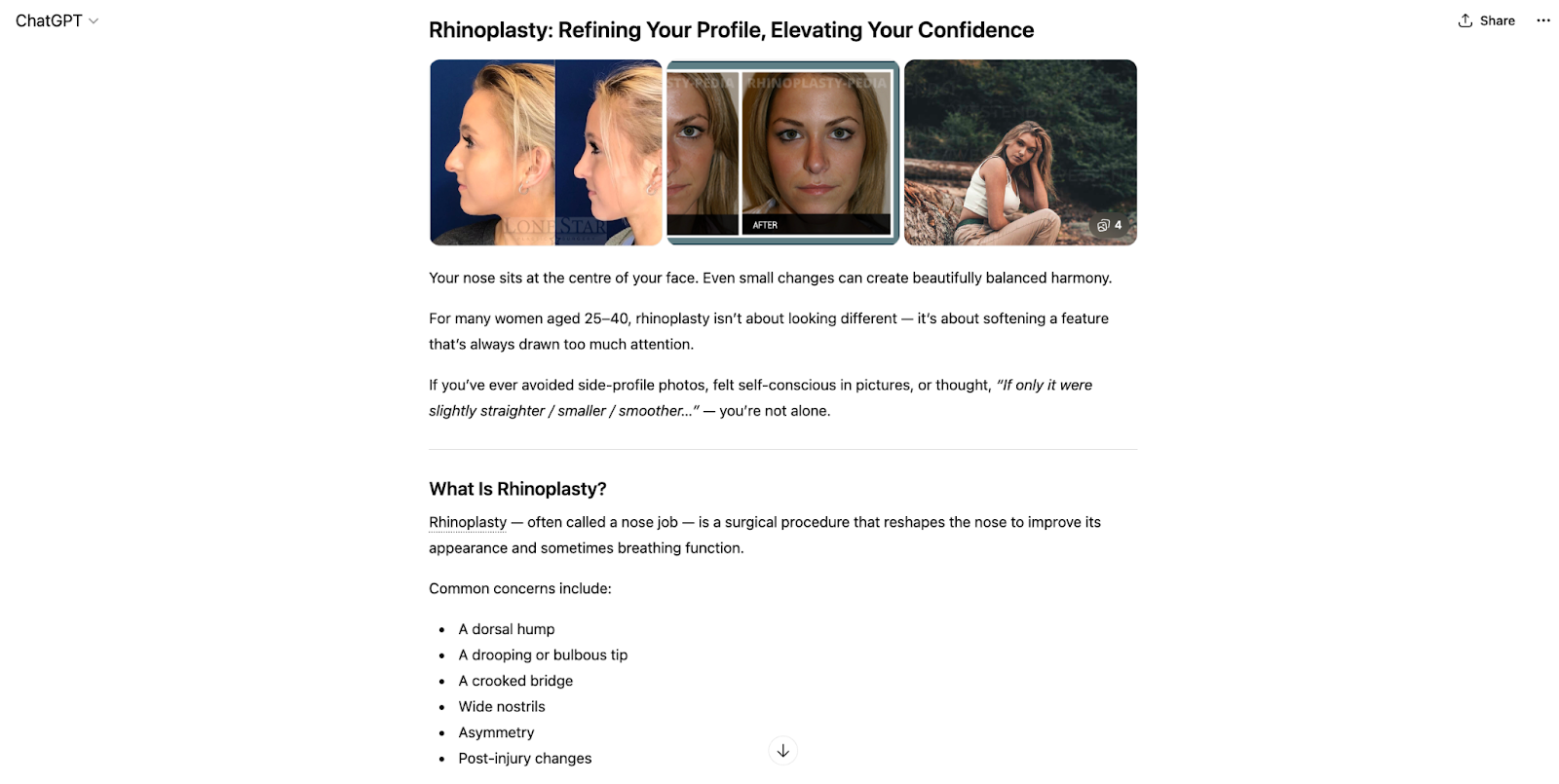 Chat GPT Answer on Rhinoplasty showcasing bias